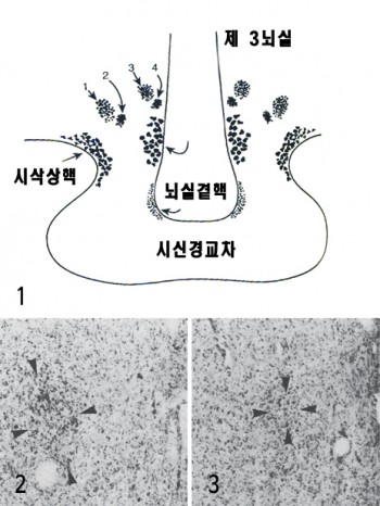 ➊ 시상하부의 시신경교차 부근을 확대한 모습. INAH로 불리는 핵 4가지(좌우 한 쌍)는 1, 2, 3, 4로 표시했다. ➋,➌ 이성애 남성의 INAH3 크기(➋, 화살표 안 짙은 영역)는 동성애 남성의 INAH3(➌)보다 평균 2배 정도 더 크다 - 사이언스 제공